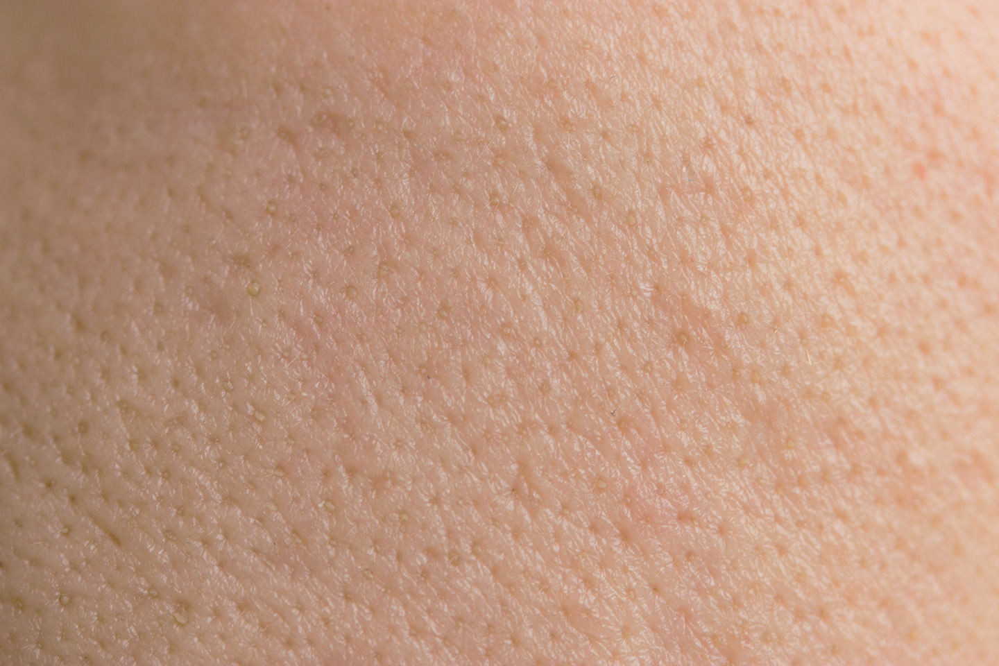 Extreme close--up van de huidtextuur, waarop de poriën als kleine putjes in het huidoppervlak zichtbaar zijn.